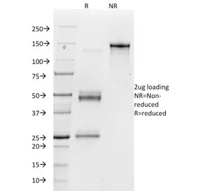 Integrin alpha V Antibody / ITGAV / Vitronectin Receptor - image 1