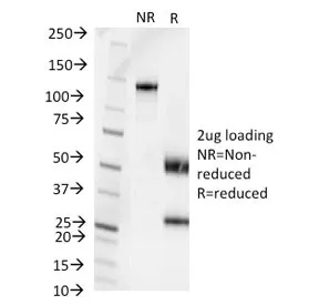 Pseudomonas aeruginosa serotype 6C Antibody - image 1