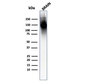 Neurofilament Antibody (Heavy + Light) - image 1