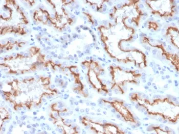 Interferon gamma Recombinant Antibody / IFNG - image 1