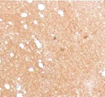 Beta Tubulin Antibody / TUBB3 - image 1
