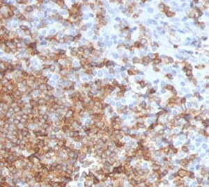 CD105 Antibody / Endoglin - image 1