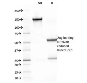 EBV Antibody / Epstein-Barr Virus - image 1