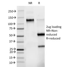 Phosphotyrosine Antibody / P-Tyr - image 1