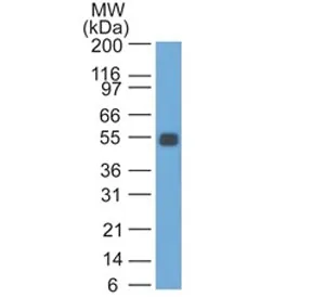 EpCAM Antibody - image 1