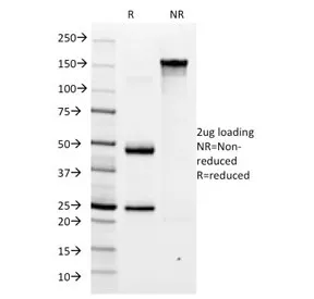Helicobacter pylori Antibody - image 1