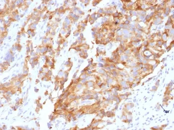 Aurora B Antibody / AURKB - image 1