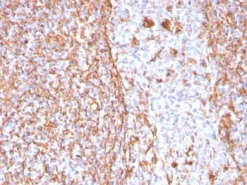 Vimentin Recombinant Antibody - image 1