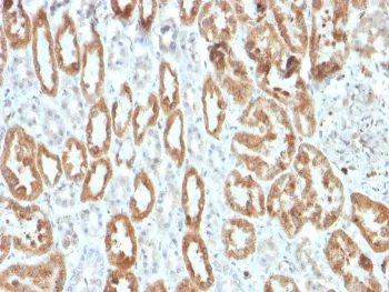 COX2 Recombinant Antibody / PTGS2 - image 1