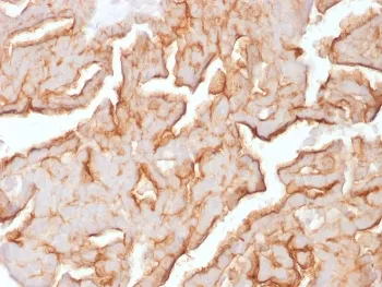 MUC16 Antibody / CA125 - image 1