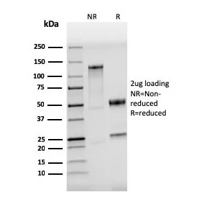 TLR4 Recombinant Antibody - image 1