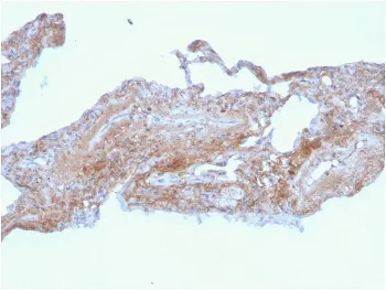 FN1 Antibody / Fibronectin - image 1