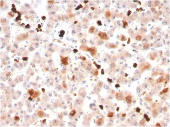 Apolipoprotein A I Antibody / APOA1 - image 1