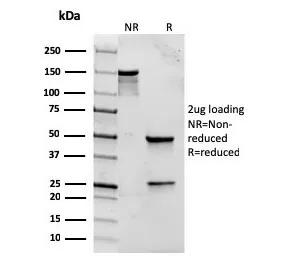 TLR2 Recombinant Antibody - image 1