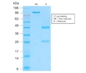 CD162 Recombinant Antibody / P selectin glycoprotein ligand 1 / PSGL-1 - image 1