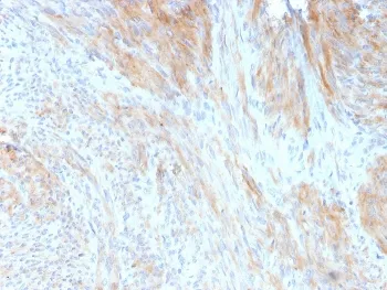 Aciculin Antibody / Phosphoglucomutase 5 - image 1