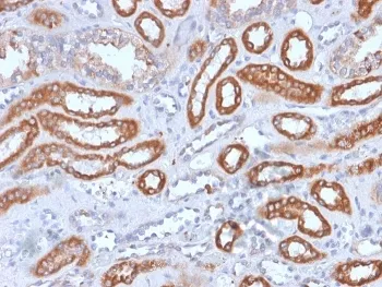 Integrin beta 3 Recombinant Antibody / ITGB3 / CD61 - image 1