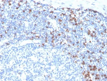Integrin alpha E Recombinant Antibody / CD103 - image 1