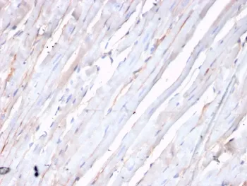 N-Cadherin Recombinant Antibody / CDH2 - image 1