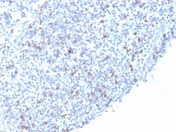 Integrin alpha E Recombinant Antibody / CD103 - image 1