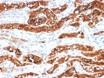 FGF21 Antibody / Fibroblast Growth Factor 21 - image 1