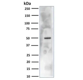 CA9 Antibody / Carbonic Anhydrase IX - image 1