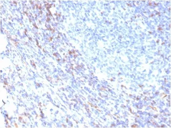 ZAP70 Recombinant Antibody - image 1