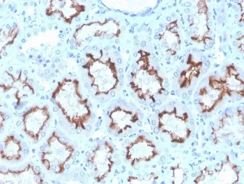 Interferon gamma Recombinant Antibody / IFNG - image 1
