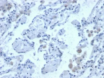 Cystatin B Antibody / CSTB / Stefin B - image 1