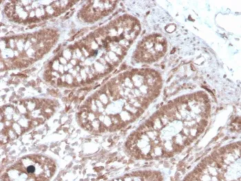ACE Antibody / Angiotensin I Converting Enzyme - image 1