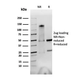 Integrin alpha V + beta 6 Antibody - image 1