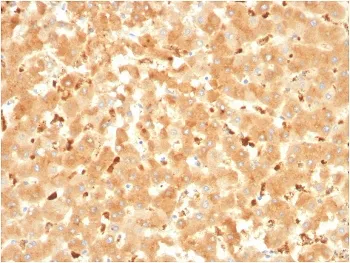 A2M Antibody / Alpha-2-Macroglobulin - image 1