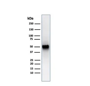 Thymidine Phosphorylase Recombinant Antibody / PD-ECGF - image 1