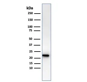 FTL Recombinant Antibody / Ferritin Light Chain - image 1