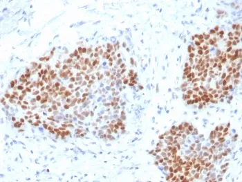 SOX9 Recombinant Antibody / SRY-box 9 - image 1