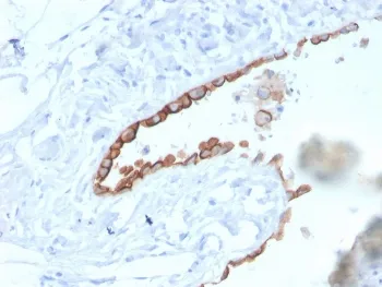 Mesothelin Antibody / MSLN - image 1