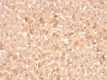 Factor VII Antibody - image 1