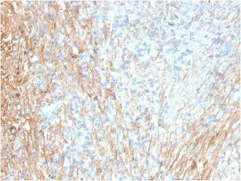 FN1 Antibody / Fibronectin - image 1