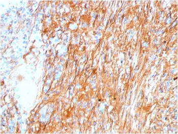 FN1 Antibody / Fibronectin - image 1