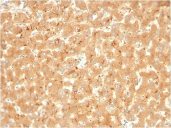 A2M Antibody / Alpha-2-Macroglobulin - image 1