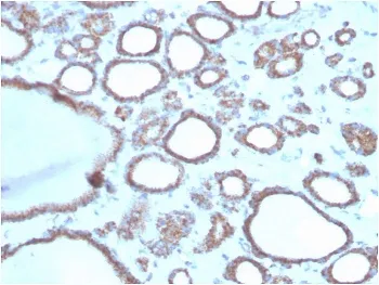 DBC2 Antibody / RHOBTB2 - image 1