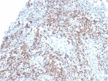 ZAP70 Recombinant Antibody - image 1