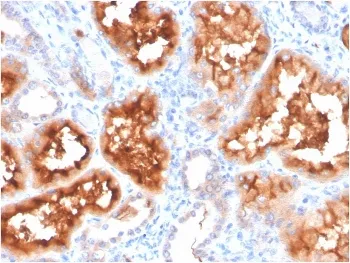 CA9 Antibody / Carbonic Anhydrase IX - image 1