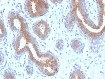 Mammaglobin A Recombinant Antibody / SCGB2A2 - image 1