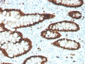 CDX2 Recombinant Antibody - image 1