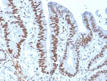 MSH6 Recombinant Antibody - image 1