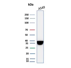 Annexin A1 Recombinant Antibody - image 1