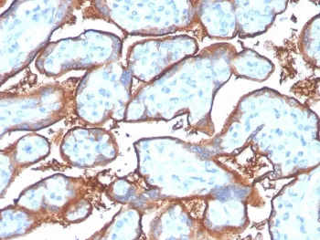 PD-L1 Recombinant Antibody / B7-H1 / CD274 - image 1