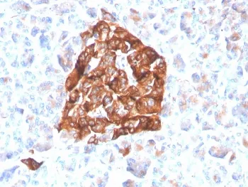 Synaptophysin Recombinant Antibody - image 1