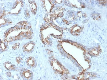 AMACR / p504S Recombinant Antibody (Prostate Cancer Marker) - image 1